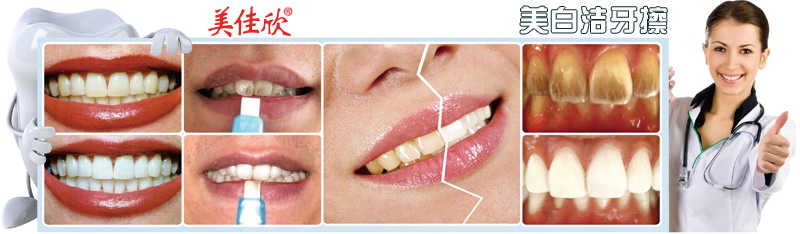 什么可以美白牙齿 美白洁牙擦效果怎么样快速擦除黄牙黑牙